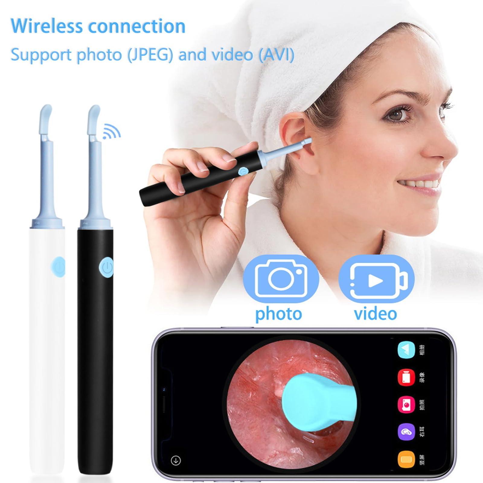 mcgotasy Earify Ear Wax Removal, Fluffora Ear Cleaner, Fluffora Pro Ear Cleaner, Astroridge Ear Cleaner, Rechargeable Ear Wax Removal Tool with Camera (Black)