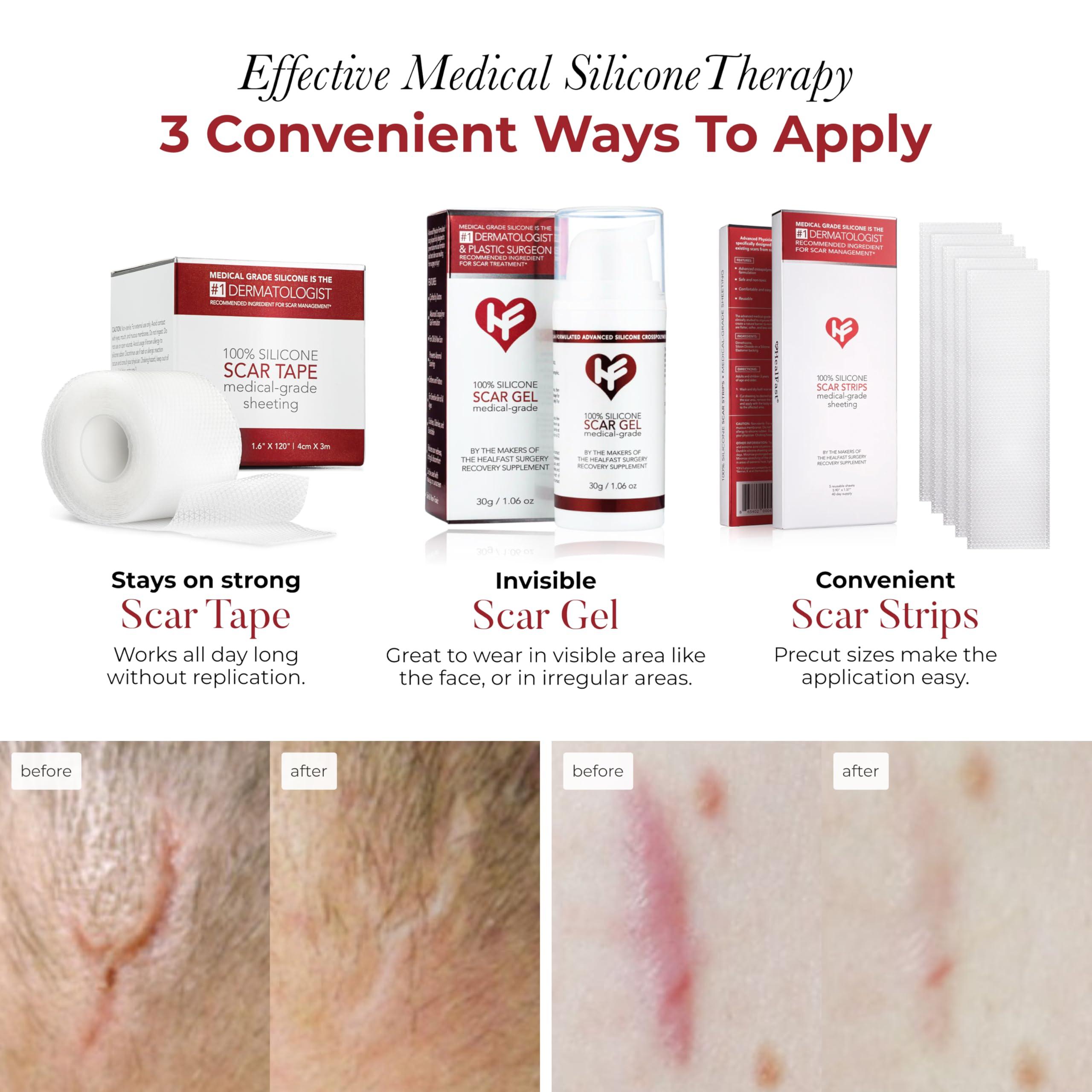 HealFast Physician Formulated Silicone Scar Sheets - Advanced Crosspolymer Medical Grade Silicone Scar Tape for Surgery, C Section, Keloids & Hypertrophic Scars - Silicone Tape For Scars - Scar Patches