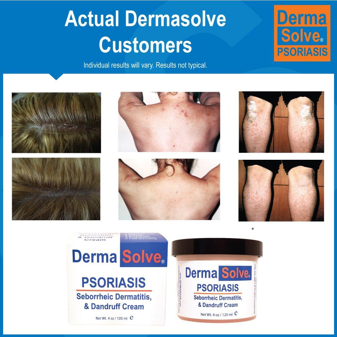 Dermasolve Dermasolve Psoriasis Complete Body & Scalp Kit