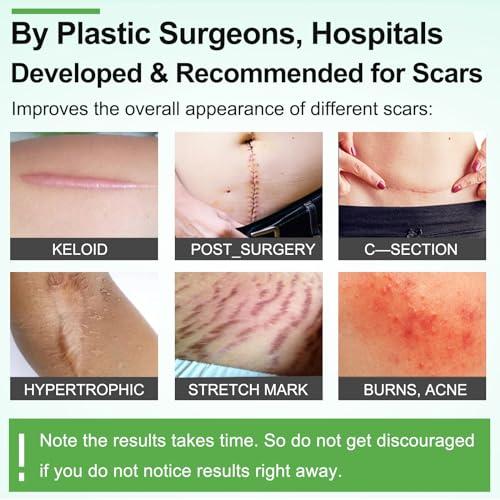 Moulis Silicone Scar Sheets (1.6” x 120” Roll-3M), Silicone Scar Tape Roll, Scar Silicone Strips, Reusable, Professional Scar Removal Sheets for C-Section, Surgery, Burn, Keloid, Acne et