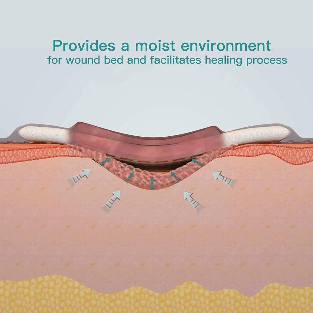 Dimora Dimora Calcium Alginate Wound Dressing with Silicone Wound Contact Layer