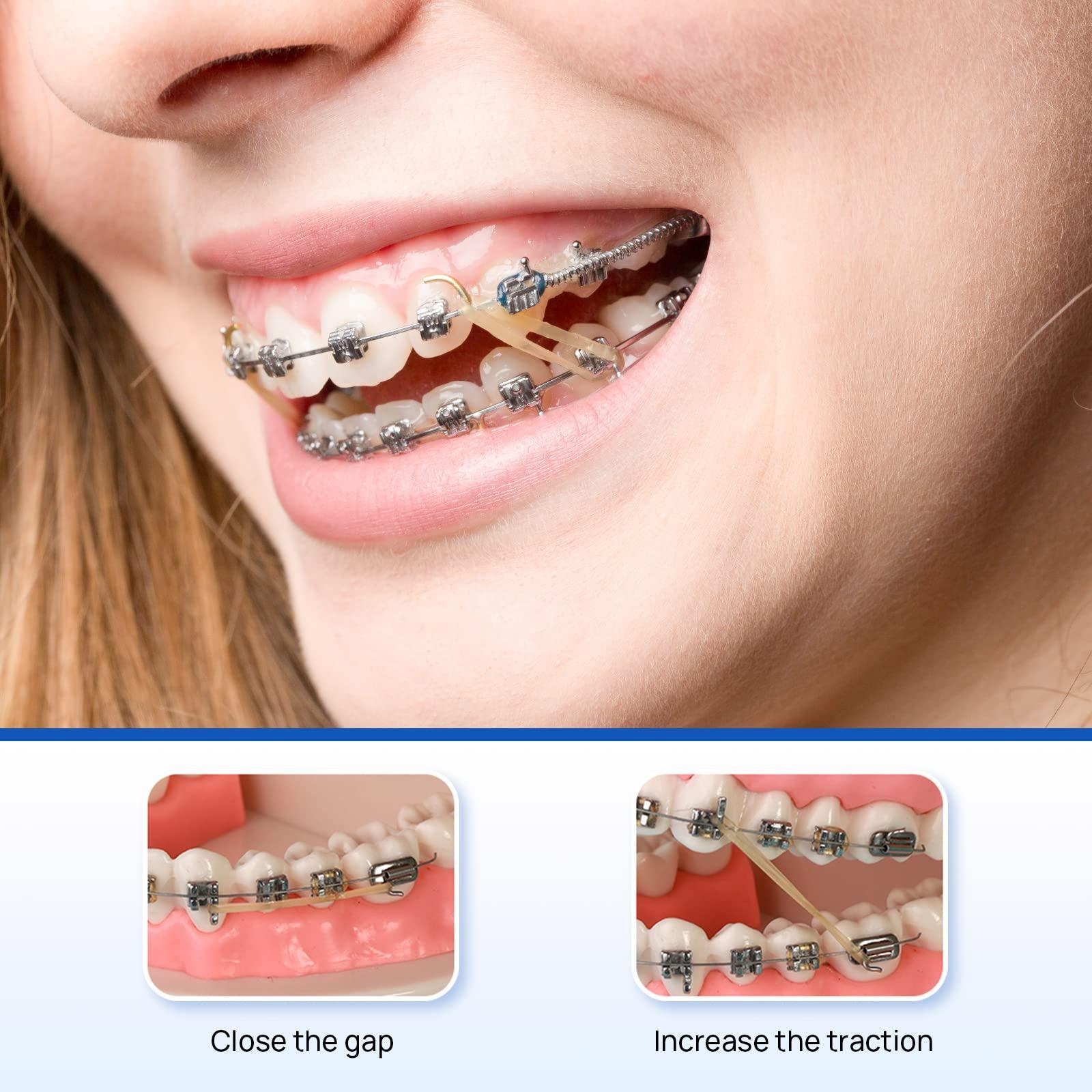 JMU JMU Orthodontic Elastics 1/4 Light 100 Pack Intraoral Elastic Bands Latex Dental Rubber Bands Made in USA