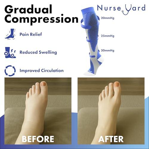 Nurse Yard Nurse Yard Compression Socks for Nurses - Women & Men - 20-30mmHg Graduated Compression, Zero-Toe Compression, For Medical Staff, Nursing, Athletic Support Such As Running, Cycling, Hiking - 1 Pair