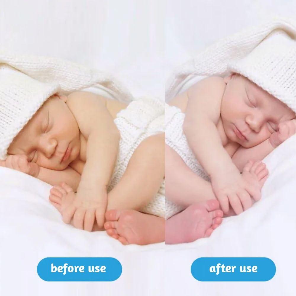 Stickfrease Jaundice Light Therapy Newborn Bilirubin Lamp Blanket Baby Neonatal Jaundice Treat Blue Ray Light 144LED Home