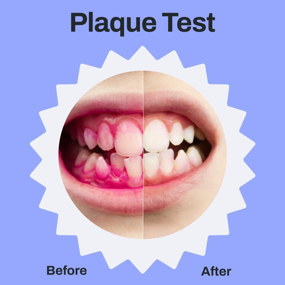 autobrush autobrush Kids U Shaped Electric Toothbrush, ADA Accepted, Sonic Pro with Unique 360 Nylon Bristles 3 Cleaning Modes,Whitening LED-Lights,Plays Music (Double-Sided),Ages 9-12, Lion