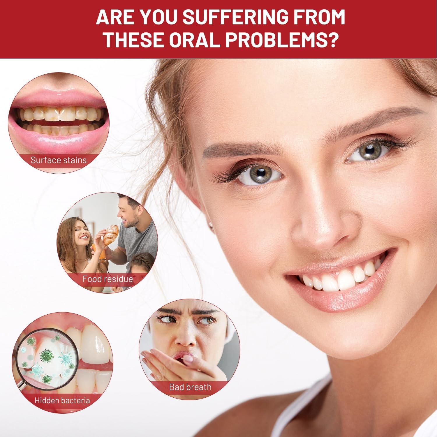 Mrryiio Sp10 Probiotic Toothpaste,Sp-10 Ultra Whitening Toothpaste,Probiotics Bright White Toothpaste,Sp-10 Probiotic Toothpaste,Sp10 Toothpaste,Fresh Breath,Deep Cleaning Care Toothpaste2Pcs