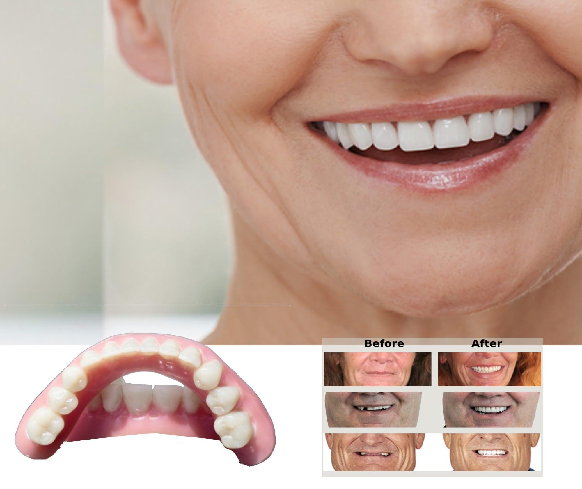 DENTUREWAY DENTUREWAY DIY Denture Kit with Impression(2 Sets of False Teeth),Do-It-Yourself Denture Solution,DIY Partial Denture kit, DIY Denture (Nature), Small