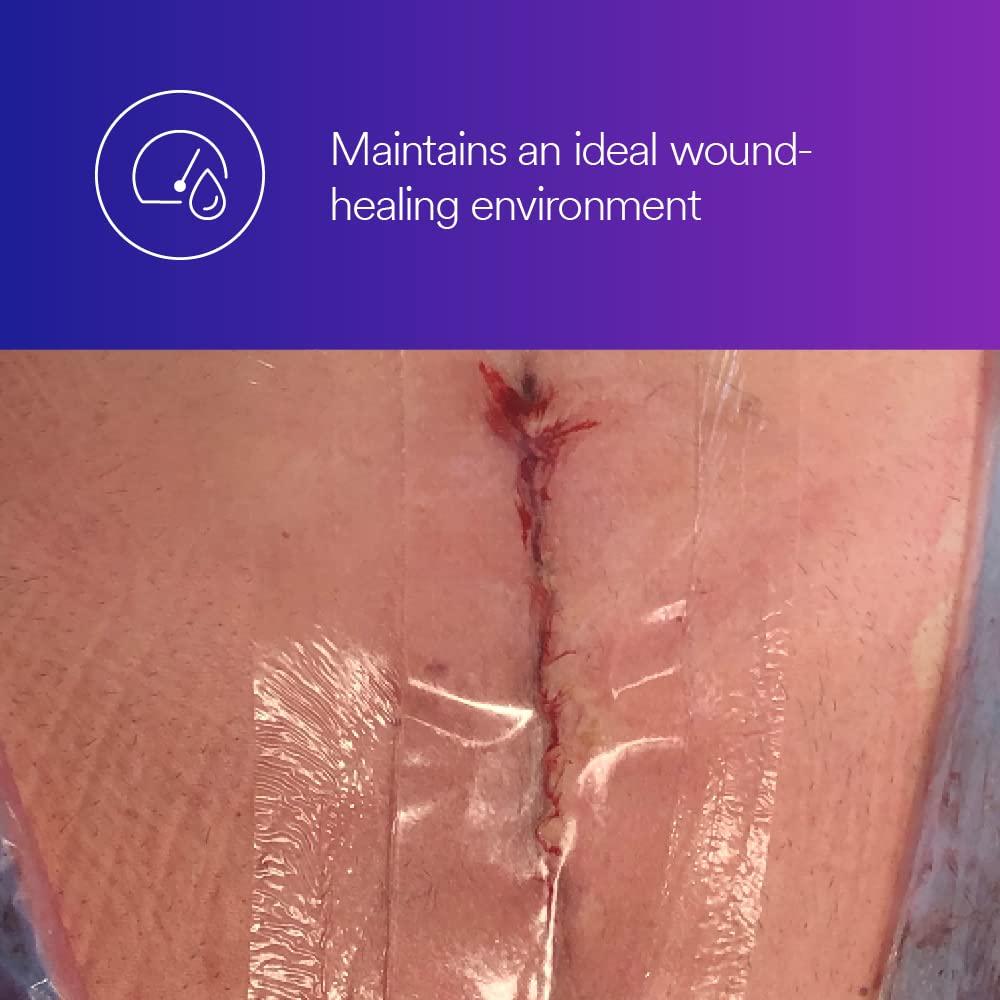 Tegaderm 3M Tegaderm Absorbent Clear Acrylic Dressing, 90800, Oval, 3 in x 3-3/4 in (7.6 cm x 9.5 cm), 10/CAR, 4 CAR/CS