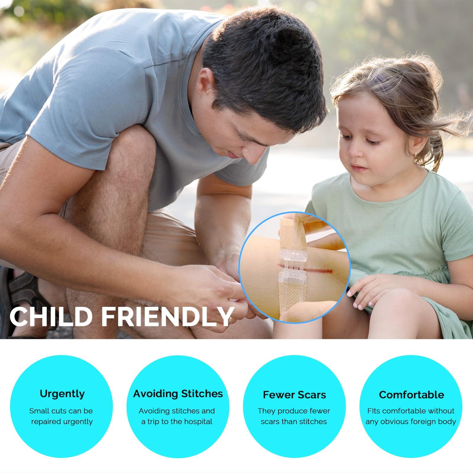 Greetmed Emergency Wound Closure Device 10 Pcs Zip Stitch Wound Closure Strips Laceration Kit Sutures Bandaids for Wounds Repair Without Sew Quick Clot First Aid Wound Care for Outdoor Hiking