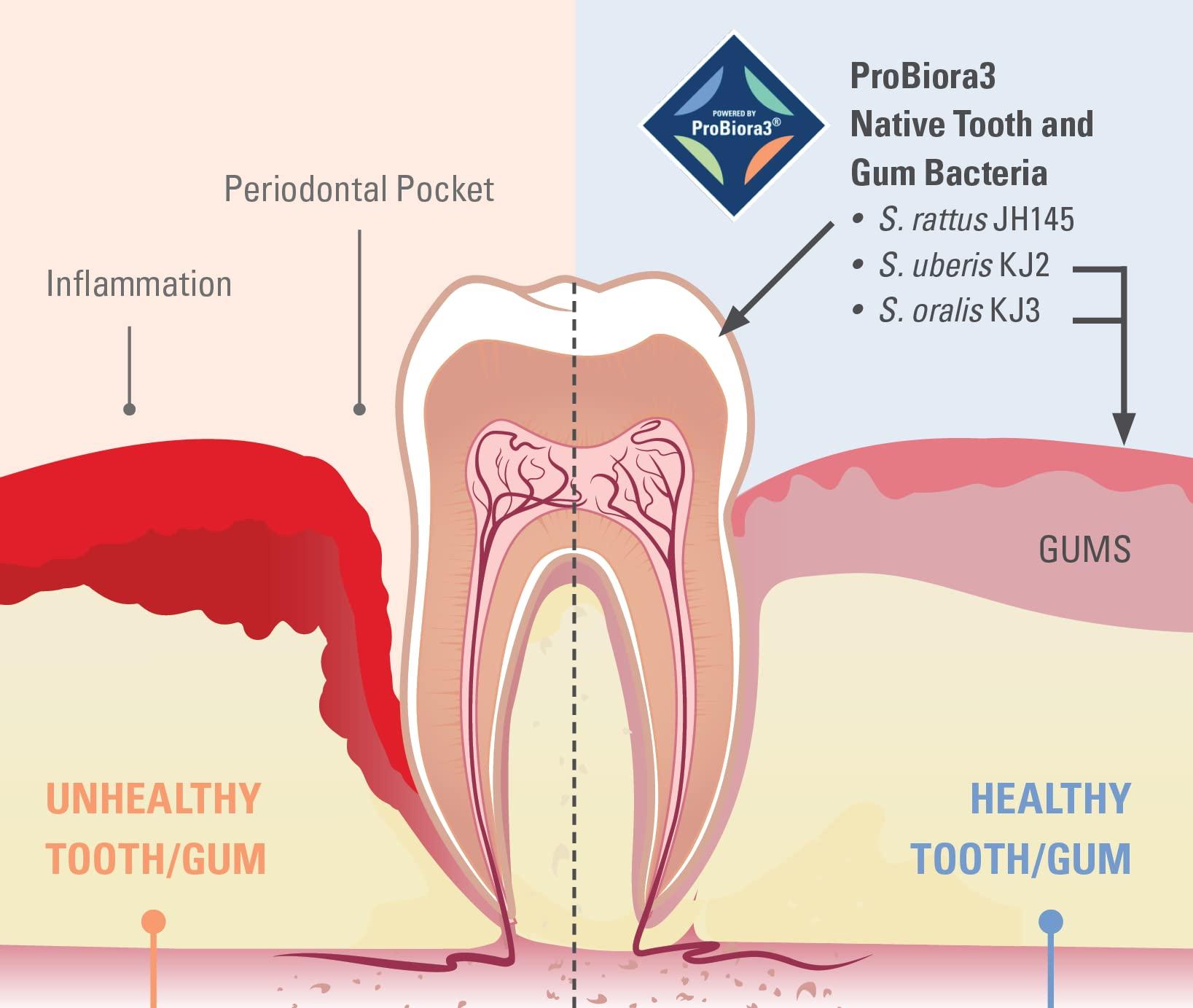 ProBiora Health ProBiora Oral-Care Chewable Probiotic Tablets | Probiotic Supplement for Women & Men | Healthier Teeth & Gums | Fresher Breath | Whiter Teeth | Better Overall Health | 30 Count | Pack of 3 | Mint