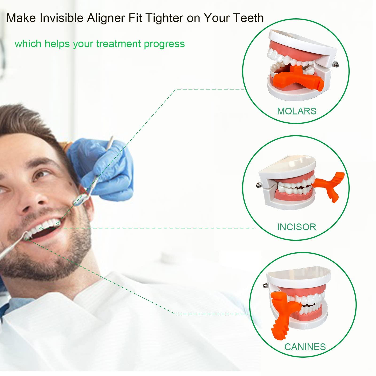 Klboccmy Chewies for Invisalign Aligners,Aligner Chewies for Aligner Trays Seater,Invisalign Munchies Orthodontic Dental Chewies Y-Shaped 2Pcs