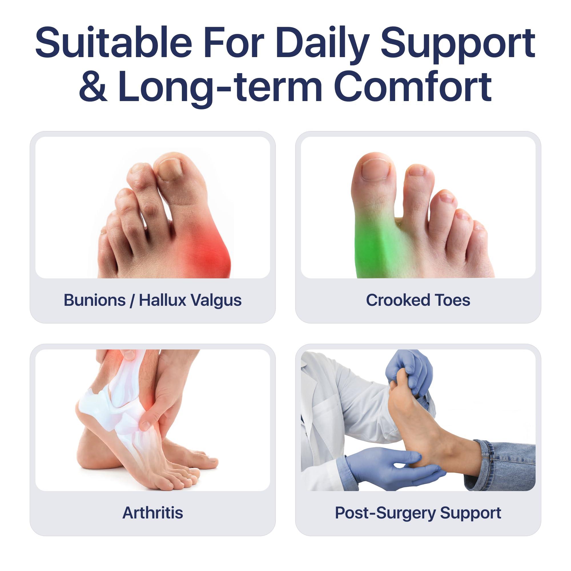 ShrooFit Effective Bunion Corrector for Women and Men | Relieve Pain, Straighten Toes, and Correct Bunions | Orthopedic Toe Straightener | Best Bunion Corrector for Lasting Relief