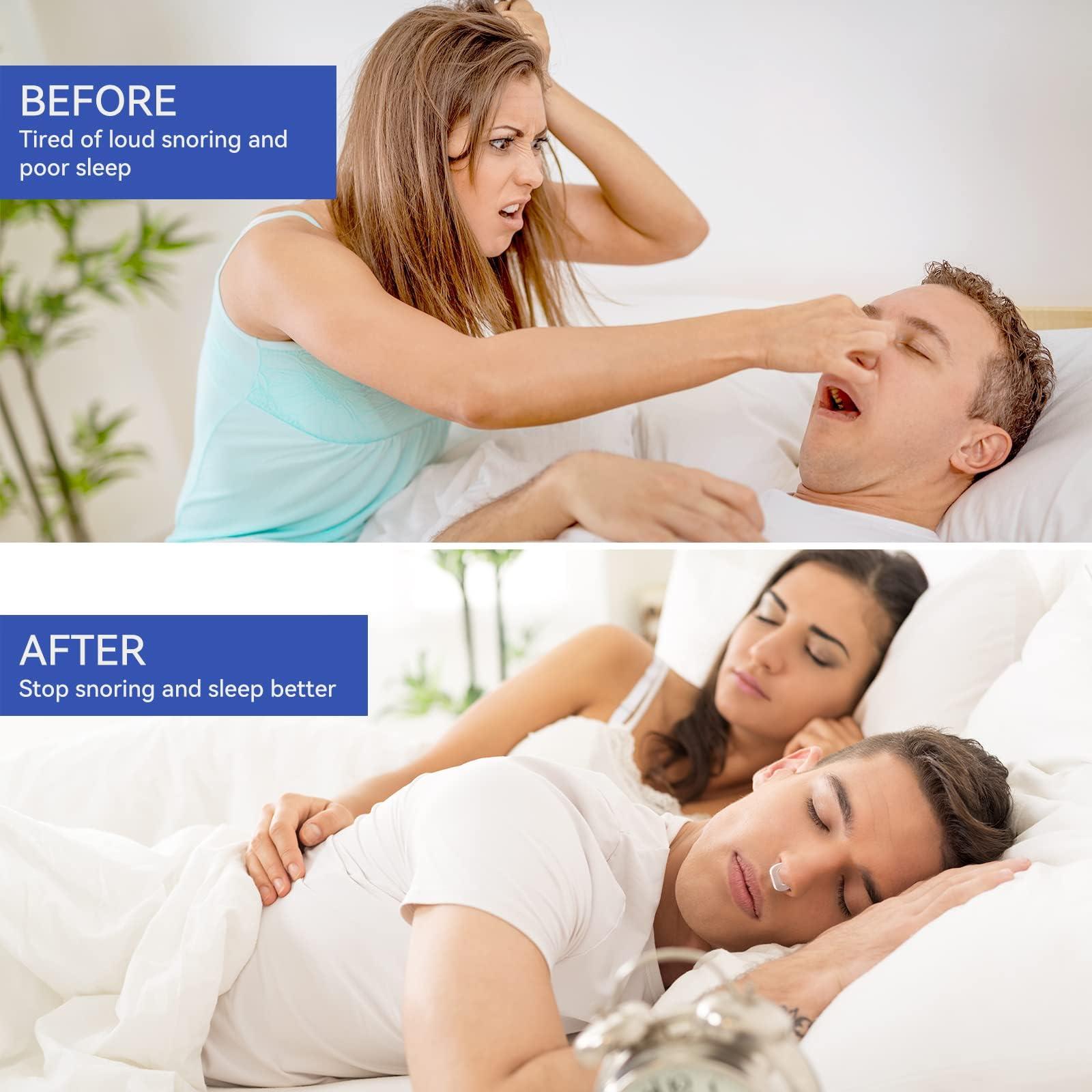 Annsky Anti Snoring Devices, Anskysea Snoring Solution - Silicone Magnetic Stop Snoring Aid for Men & Women - Anti Snoring Nose Clip10 Pack