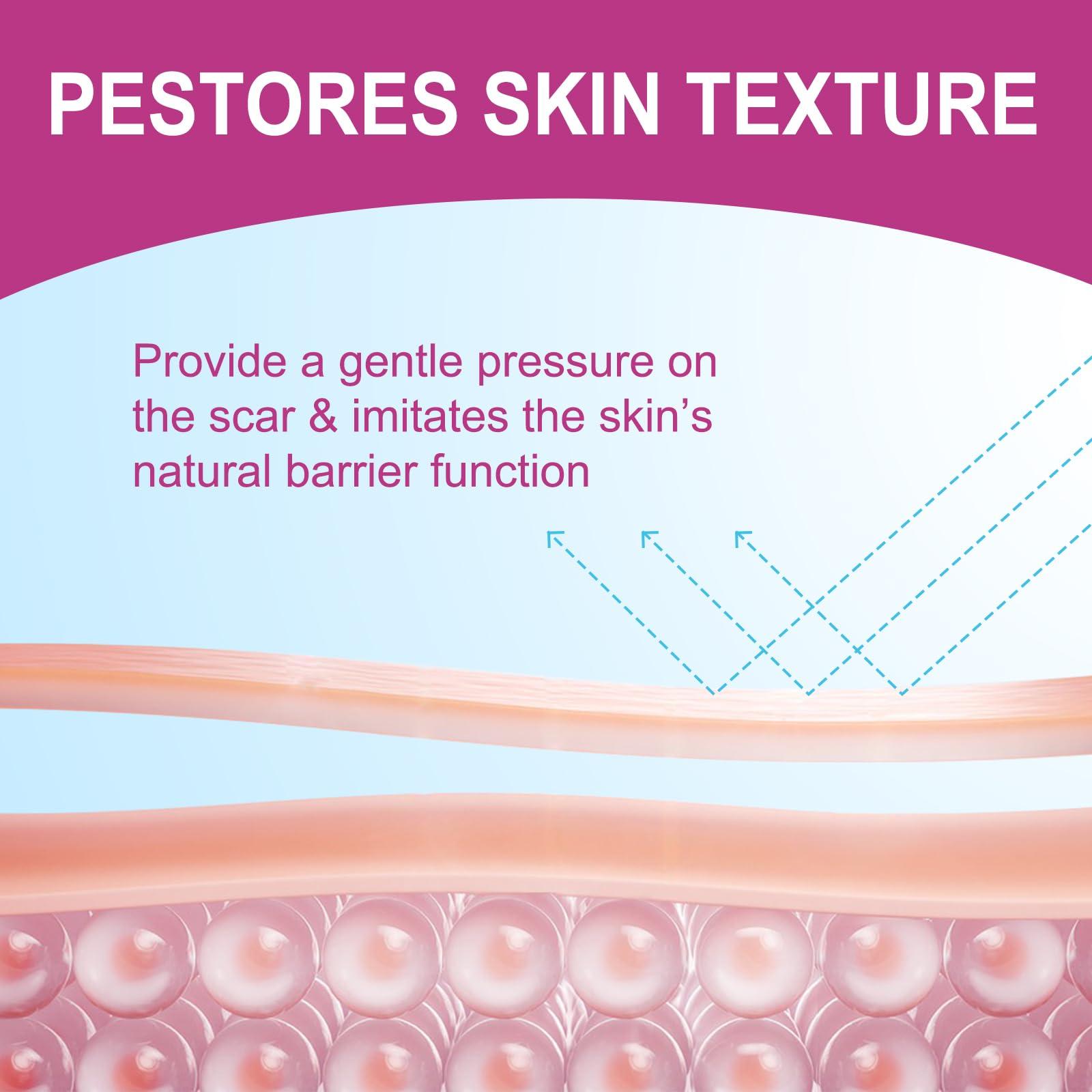 ONE1X Silicone Scar Sheets,Silicone Scar Tape Roll,Medical Grade Silicone Tape for Scar Removal,Reusable Professional Scar Treatment Patch for C-Section,Keloids,Surgical,Acne (Roll Size 1.6\'\'x75\'\'-1.9M)