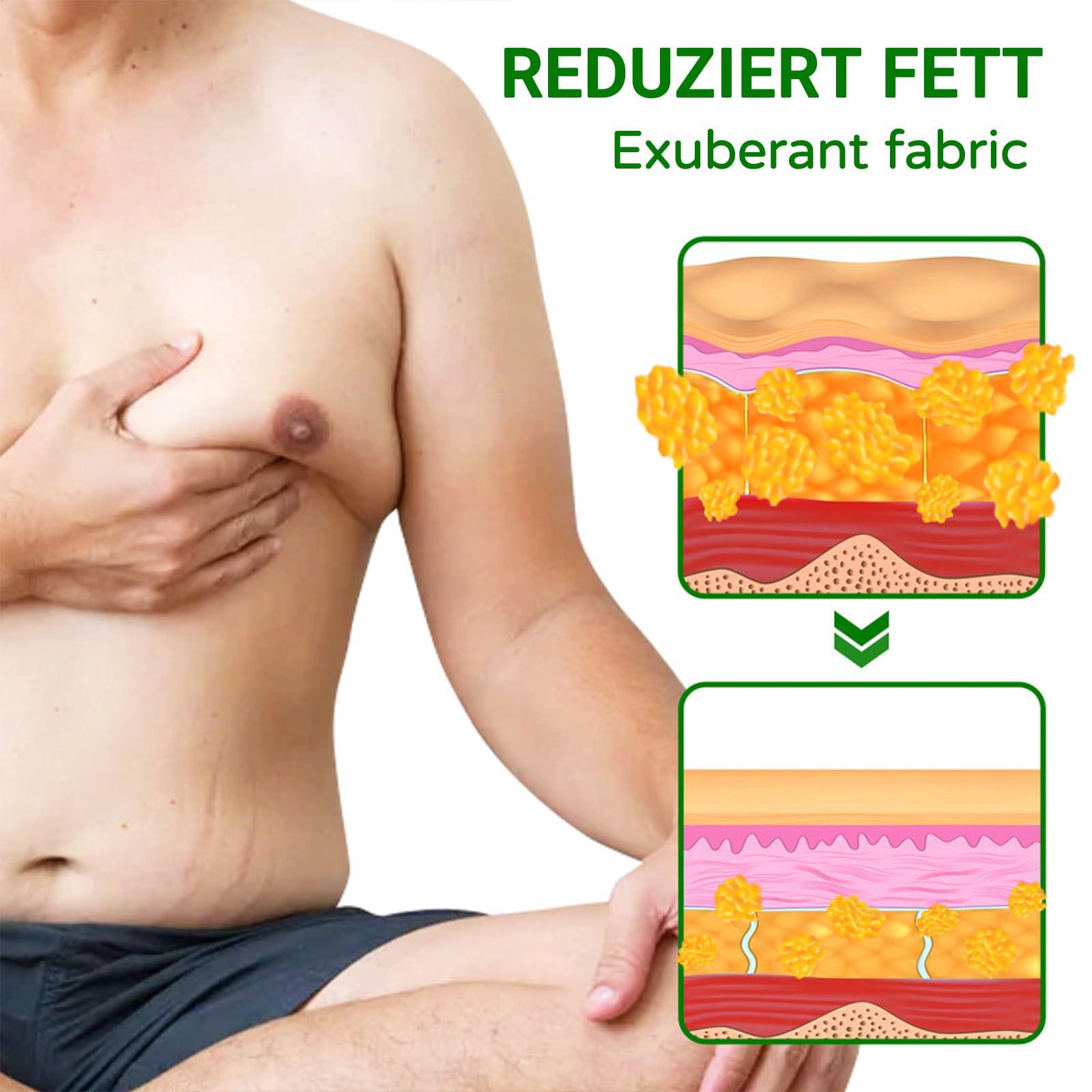 GFOUK Gynecomastia Compress Patch - Ginger Cream for Men, Tightening and Sculpting Chest Muscles with Natural Ingredients (2Pack)