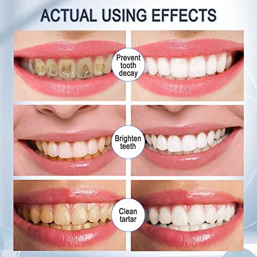 VOGSIG Teeth Whitening Toothpaste with Fluoride, Foam Toothpaste, Ultra-fine Mousse Foam Deeply Cleaning Gums, Stain Removal, Oral Care-Toothpaste Replacement Natural Mouth Wash Water, 3 Fresh Flavor
