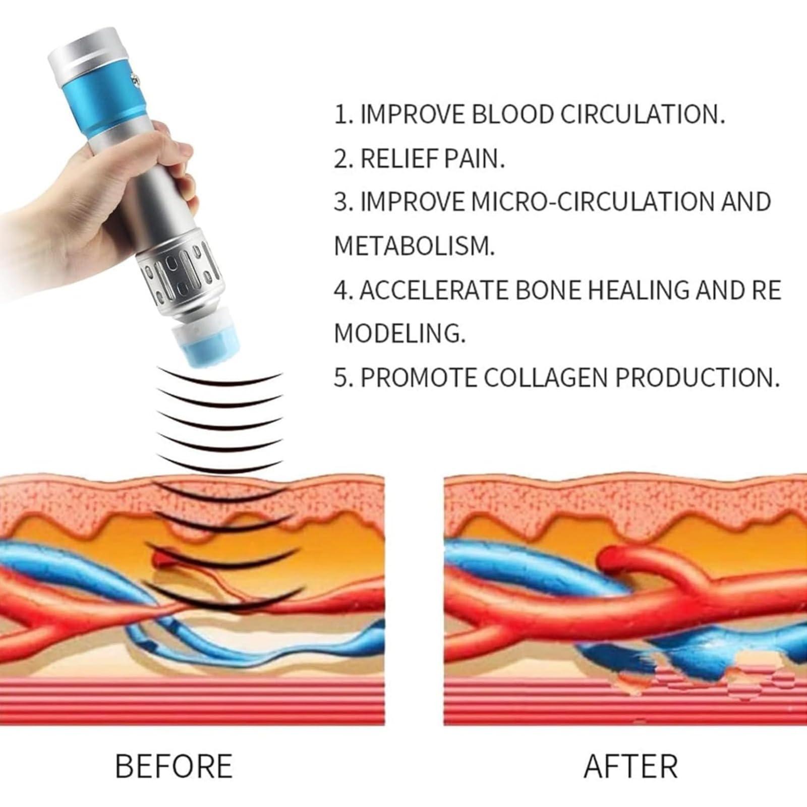 AECEVAN Shockwave Therapy Machine Extracorporeal ESWT Shockwave Therapy Machine for Joint and Muscle Pain Relief ED Treatment, Muscle and Bone Tissue Regeneration No Side Effects (A)