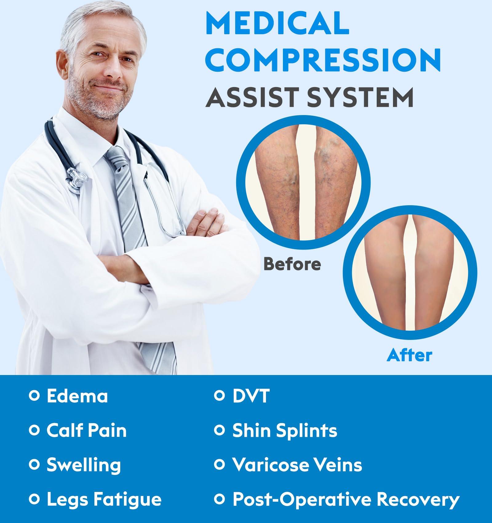 MGANG MGANG 20-30 mmHg Compression Stocking for Men and Women, Medical Compression Socks, Knee High Length, Open Toe, for DVT, Varicose Veins, Relief Shin Splints, Edema, Beige XX-Large