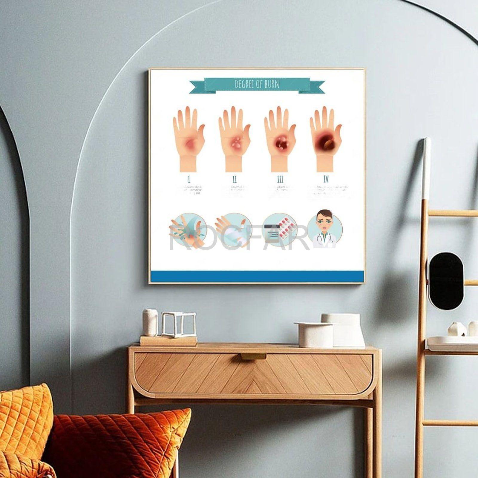 PRIMUZ First Aid Knowledge Poster Skin Burn Measures Procedure Emergency First Aid Knowledge Guide Canvas Poster Wall Art Decor Print Picture Paintings for Living Room Bedroom Decoration Frame-style 8x8inch(