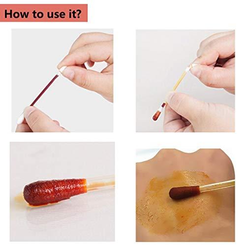 QWKIT 100pcs Disposable Iodine Swab Cotton Swab Medical Iodine Cotton Stick Clean Wounds Care for Outdoor Medical Supplies (Medical Iodine Swab)