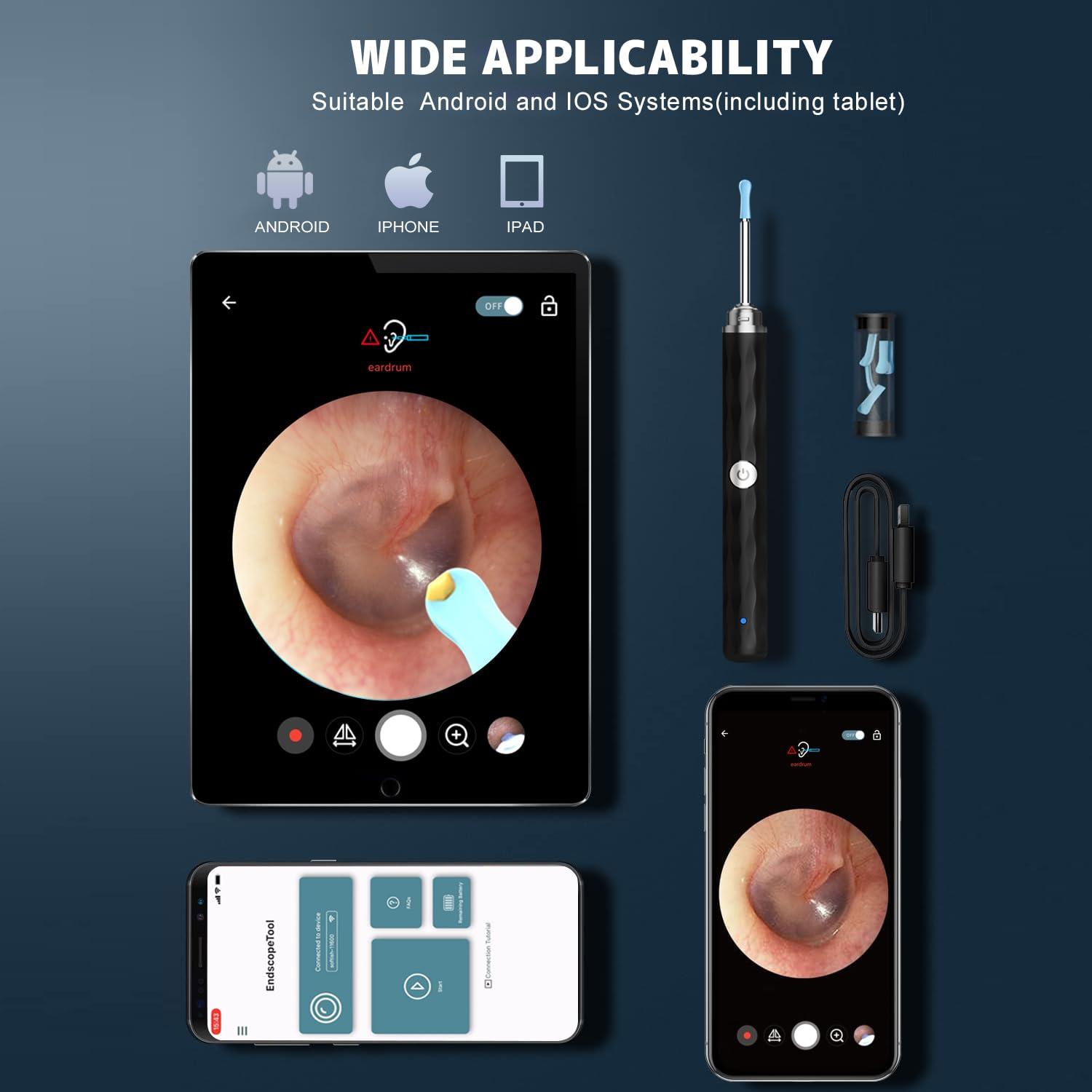 Right Ear Wax Removal, Ear Cleaner with Camera and Light, Ear Wax Removal Kit with 1296P Otoscope, Ear Cleaning Tool with 6 Ear Spoon, Ear Camera for iPhone & Android Phones,Black