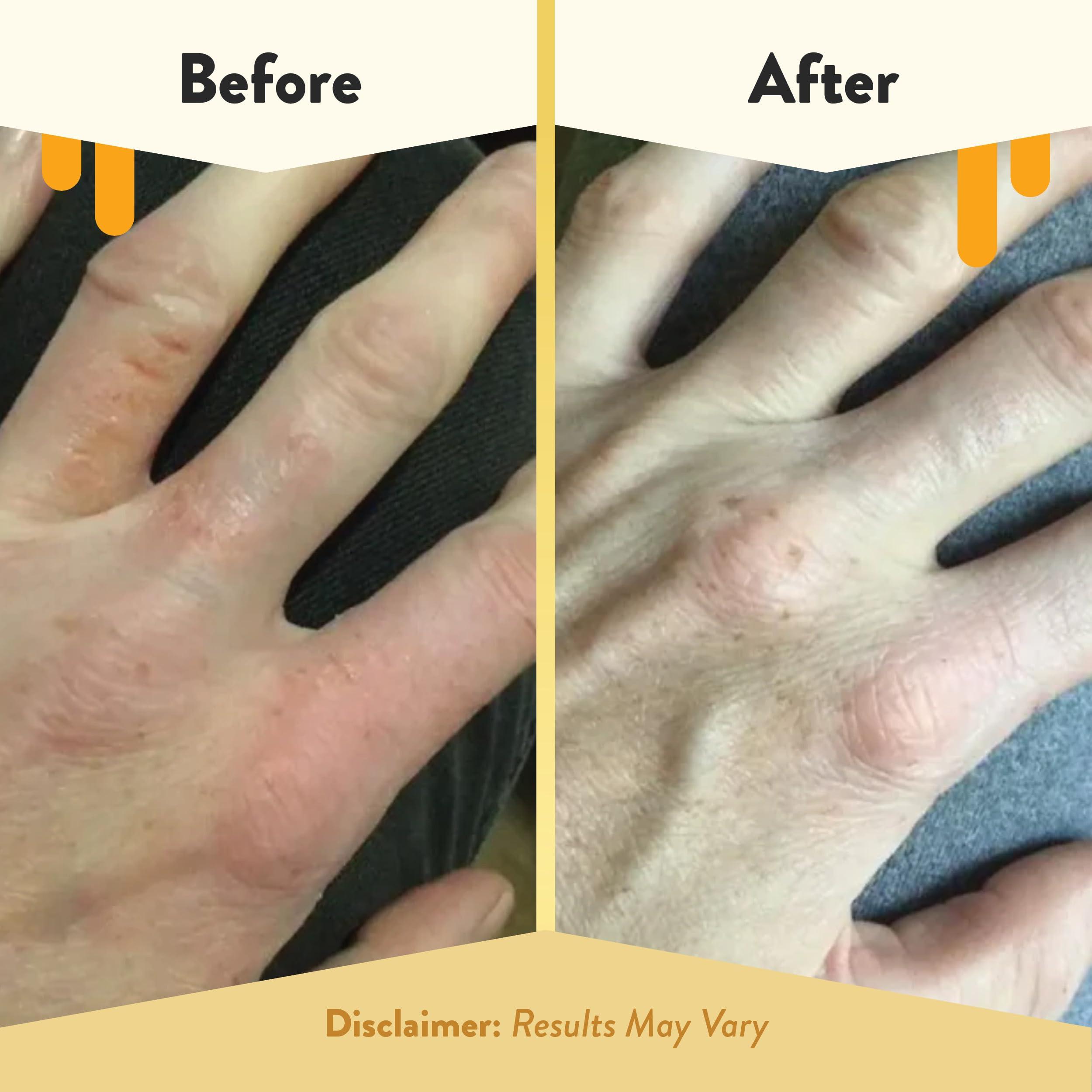 ECZEMA HONEY ECZEMA HONEY Oatmeal Hand Cream - Natural Hand & Body Lotion for Eczema Rash Relief - Eczema Cream for Dry, Itchy, Sensitive, & Irritable Skin (2 Oz)