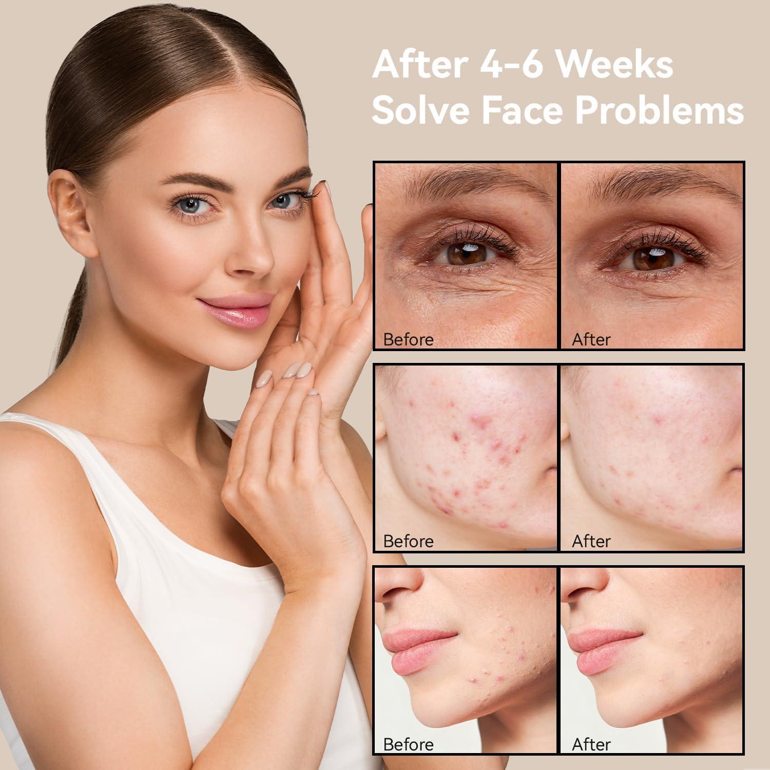 MEGELIN MEGELIN Led Red Light Therapy Mask,7 Colors Led Light Therapy Facial Mask