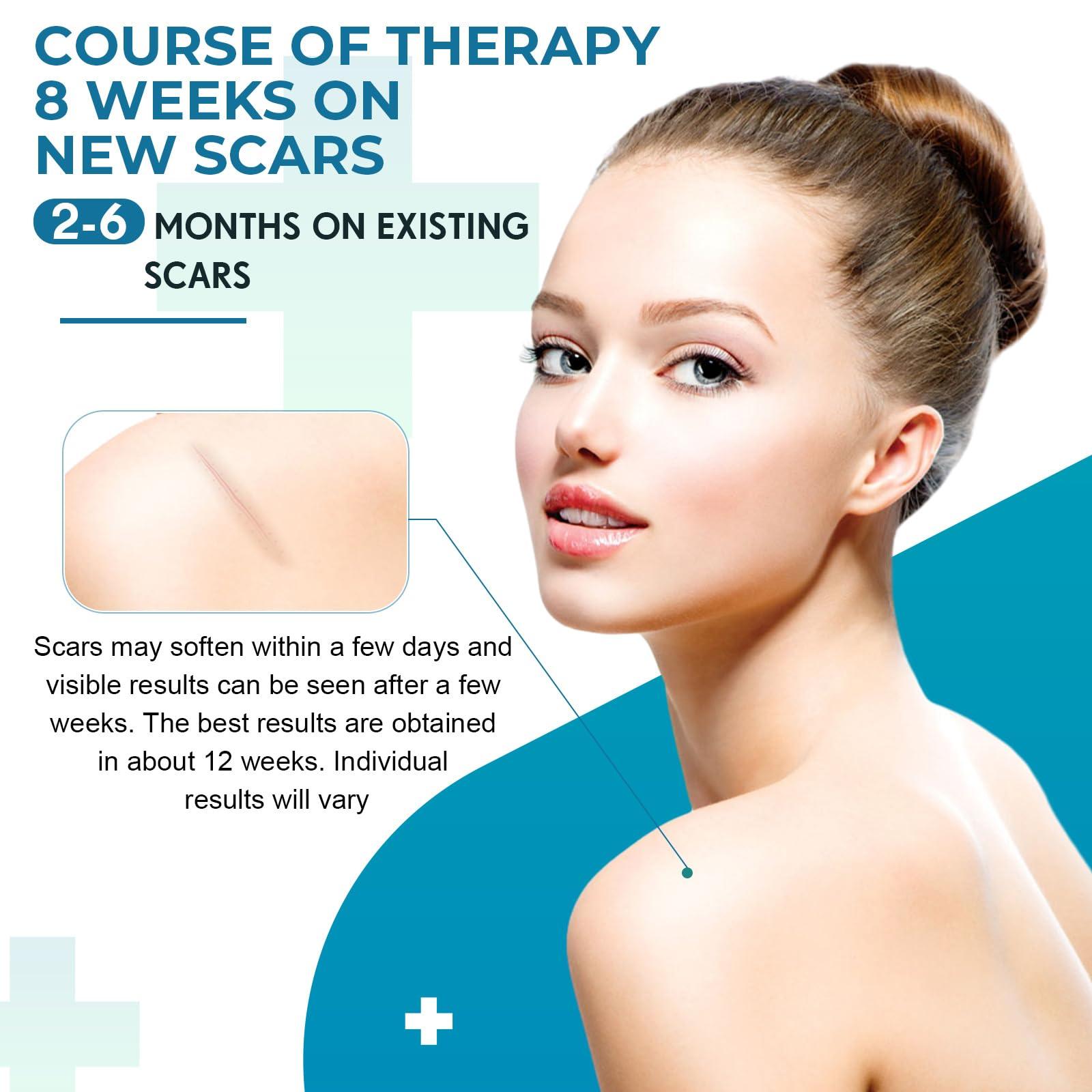 Rvlaim Silicone Scar Sheets, Silicone Scar Tape(1.6x 60 Roll-1.5M), Silicone Scar Strips, Professional Scar Removal Sheets for Surgical Scars, Keloid, C-Section, Burn et