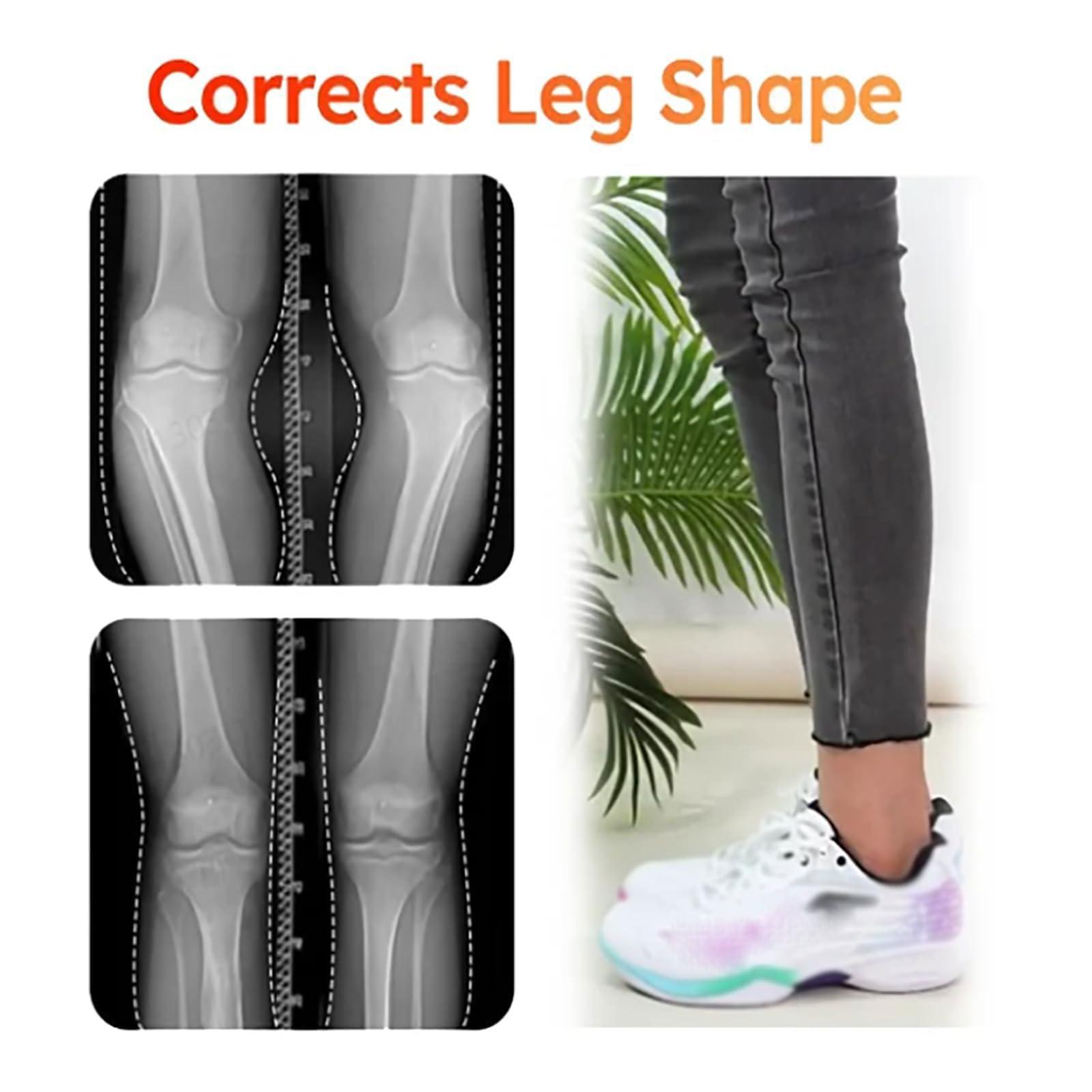 Insoles Steppers Insoles, Steppers Shoe Inserts for Men and Women, Revolutionary Orthopedic, Breathable and Sweat-Wicking (Black, 41-42mm)