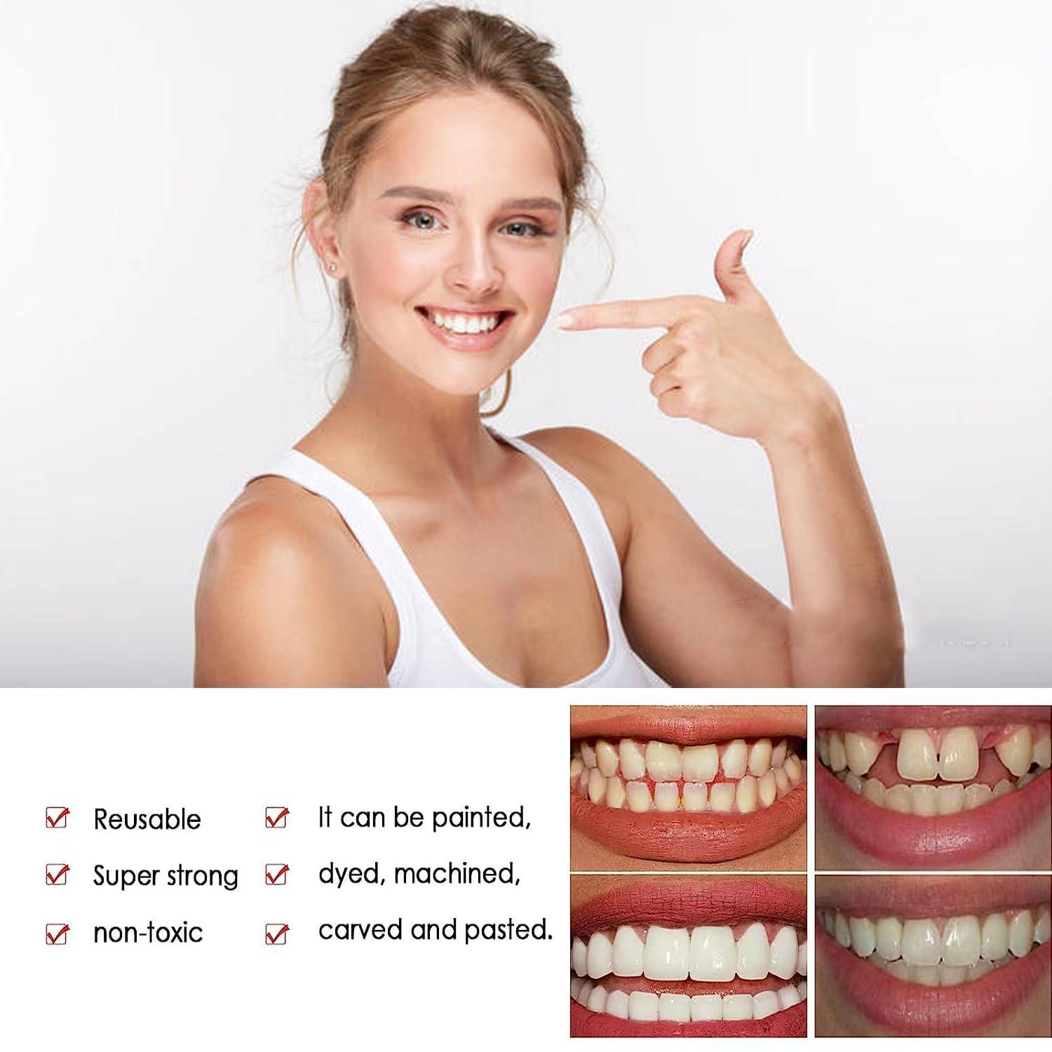womcare Fake Tooth Repair Kits DIY Dental Care Kit Glue for Filling Missing Broken Teeth Crowns and Bridges Moldable Fake Teeth to Regain Your Beautiful Smile in Minutes-White Color