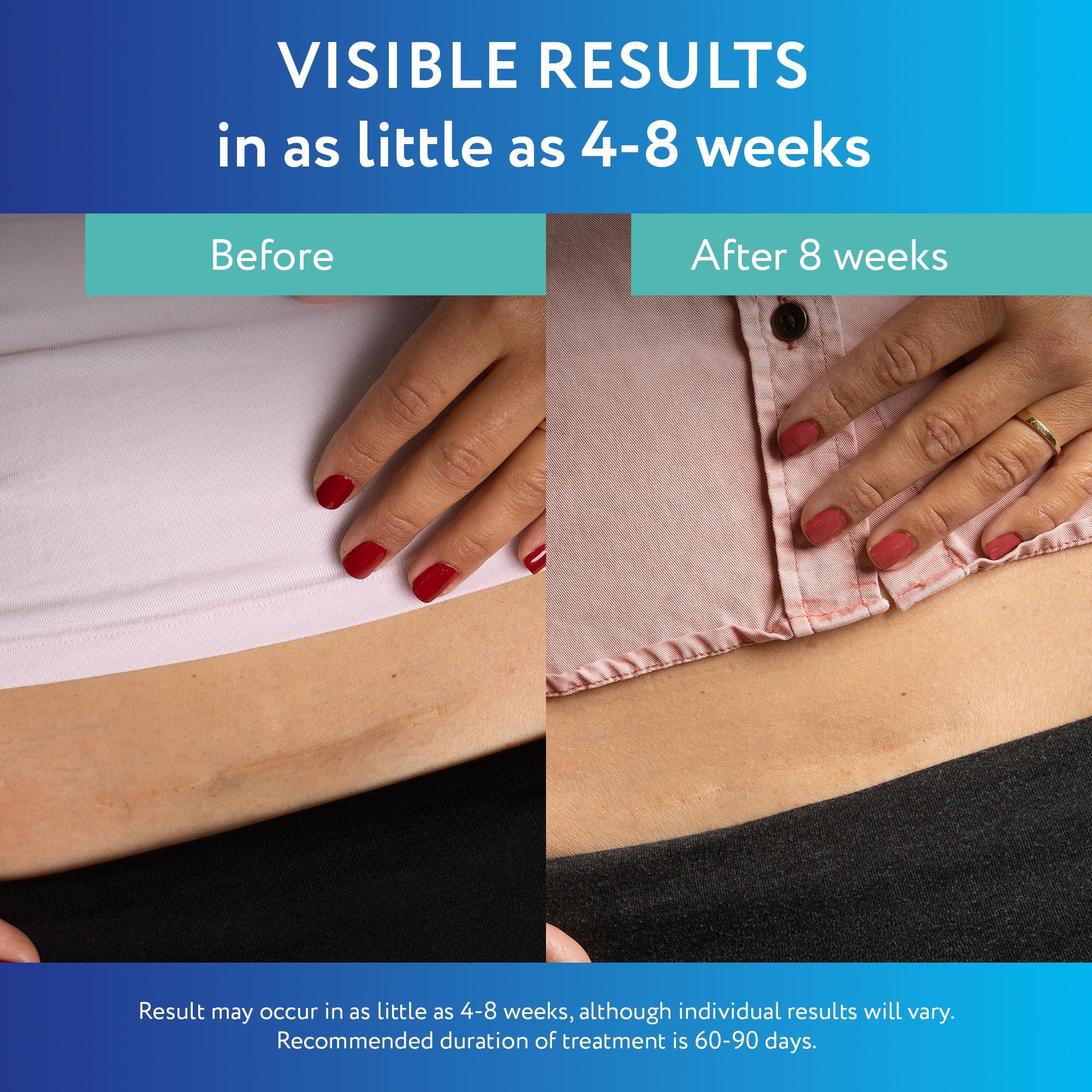 ScarAway ScarAway Advanced Clear Silicone Scar Sheets, Medical Grade Silicone Strips (1.5\" x 3\") Scar Treatment and Prevention for Surgical, Burn, Body, Hypertrophic & Keloid Scar Treatment, 10 Clear Sheets