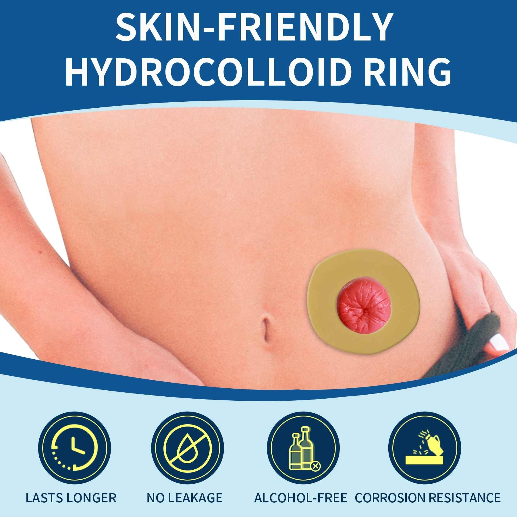 ovand Ostomy Barrier Rings - Ostomy Supplies - 2 mm Thickness Moldable Ostomy Rings Medical Grade Hydrocolloid Adhesive Barrier Rings Better Seal for Ostomy Bags (Box of 10)