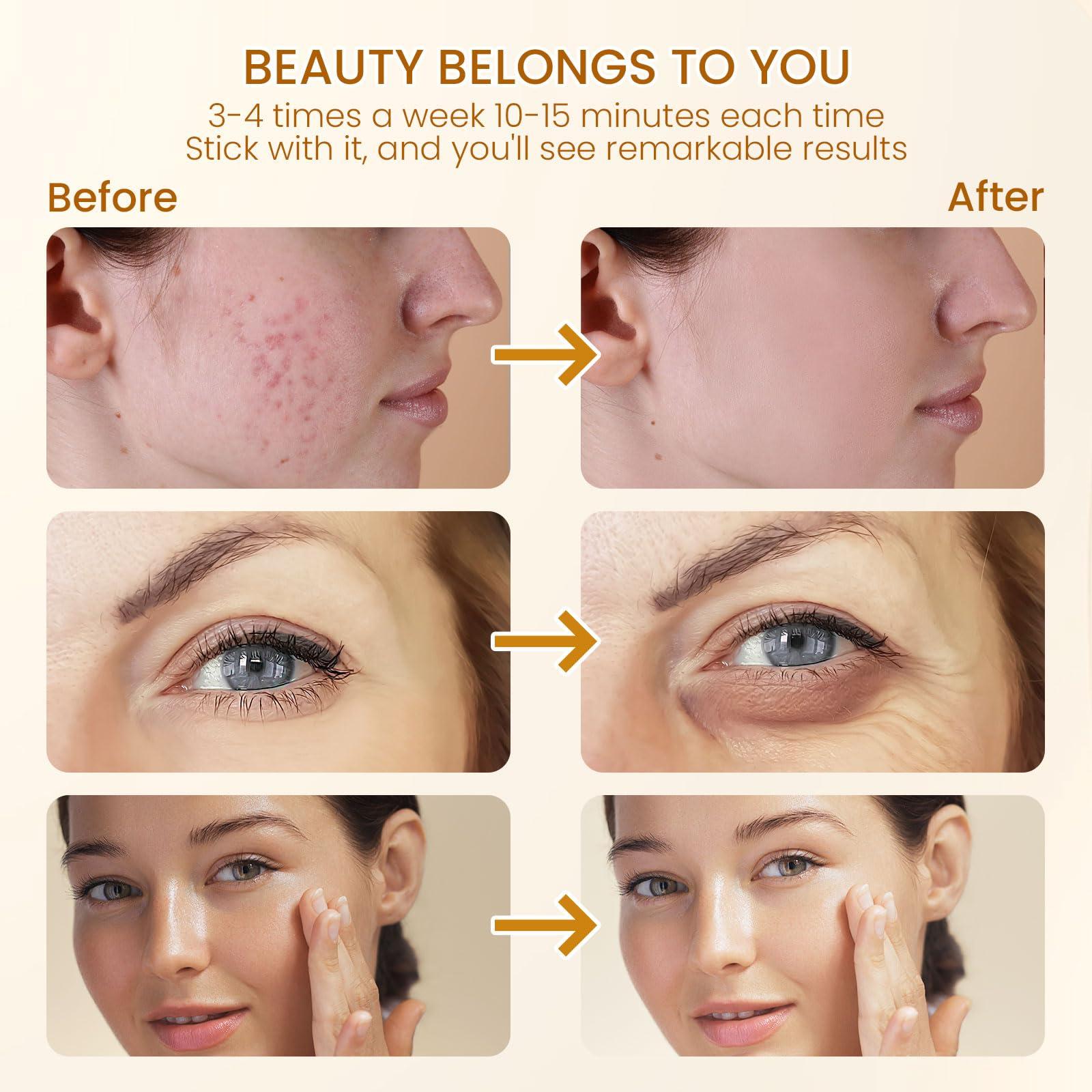 Devowellte 7 Colors LED Red Light Therapy Lamp with Stand & 7 Color Red Light Therapy Lamp with Base