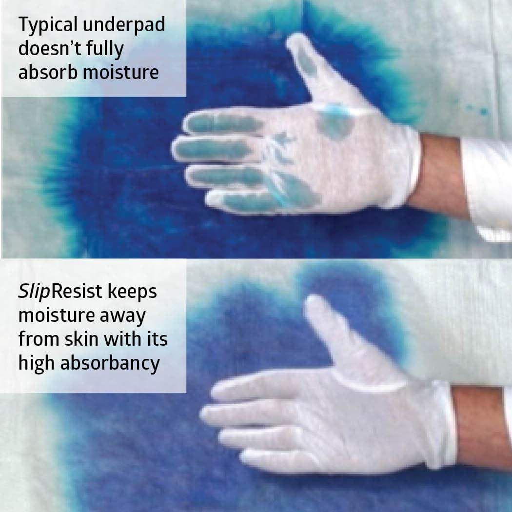 Medline Medline Ultrasorbs Drypads with SlipResist Technology, 30\" x 36\", 5 Count, Super Absorbent Disposable Bed Pads, Incontinence Bed Pads, Adult Bed Pads, 10x More Absorbent, Chucks For Adults, Elderly