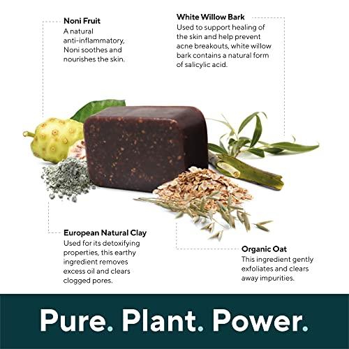 MARIE'S ORIGINAL Marie Originals Acne Bar Soap Cleanser for Face and Body | Acne Treatment with Bentonite Clay, Organic Oat Bran, Noni Fruit Powder, White Willow | Natural Body Wash for Pimples and Scars (1 Pack)