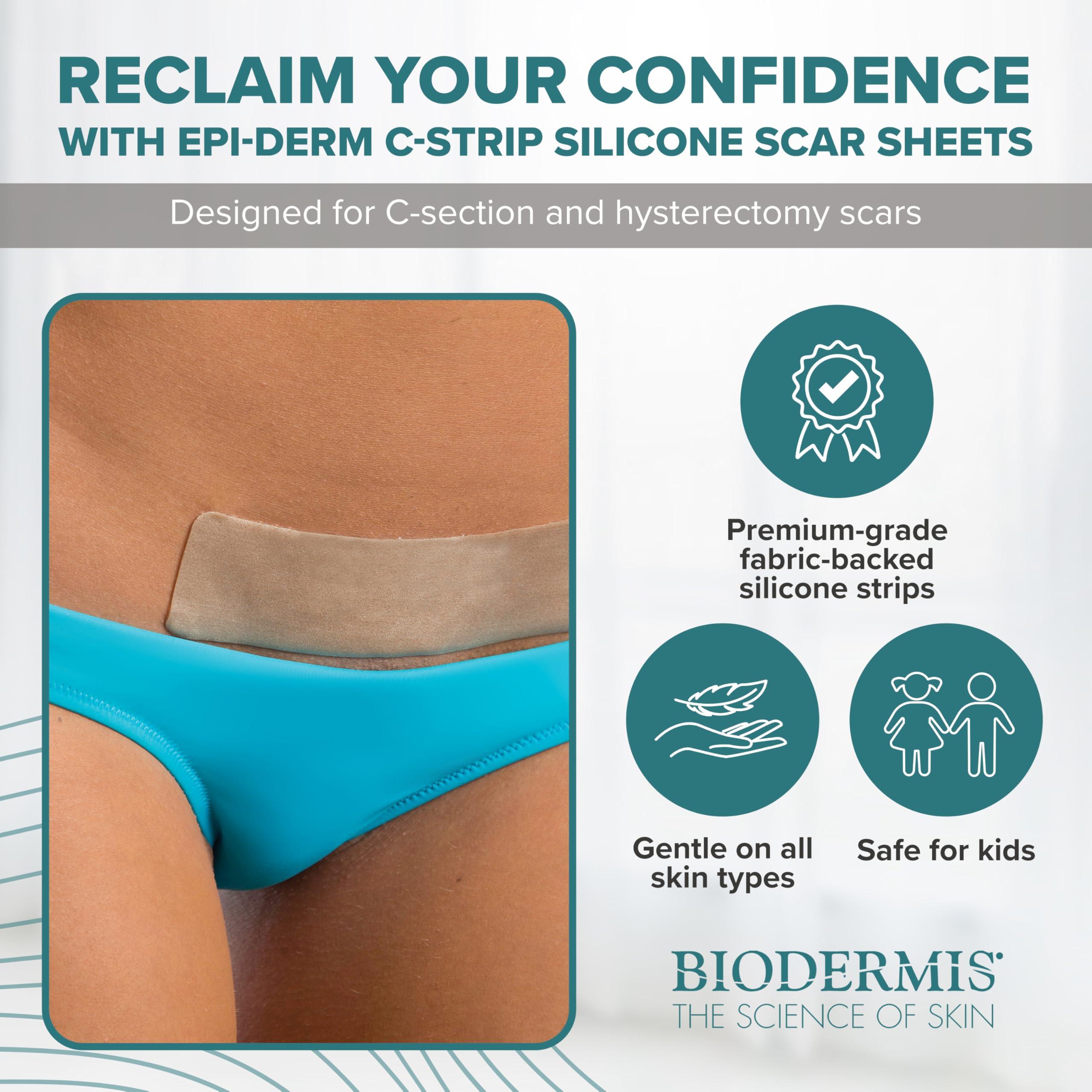 BIODERMIS Epiderm Silicone Gel Scar Sheets - Premium-Grade Silicone Scar Sheets for Optimal Scar Care - Versatile, Flexible & Reusable - Ideal for C-Section, Tummy Tuck & Hysterectomy Scars - 1.4x6 in, Natural