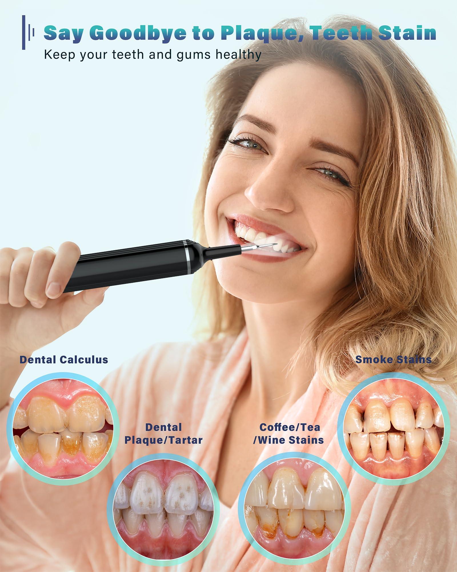 NATURE NERDS Plaque Remover for Teeth, Dental Cleaning Kit Tartar Remover for Teeth with LED Light & 5 Modes, Rechargeable Dental Cleaner, 4 Replaceable Heads