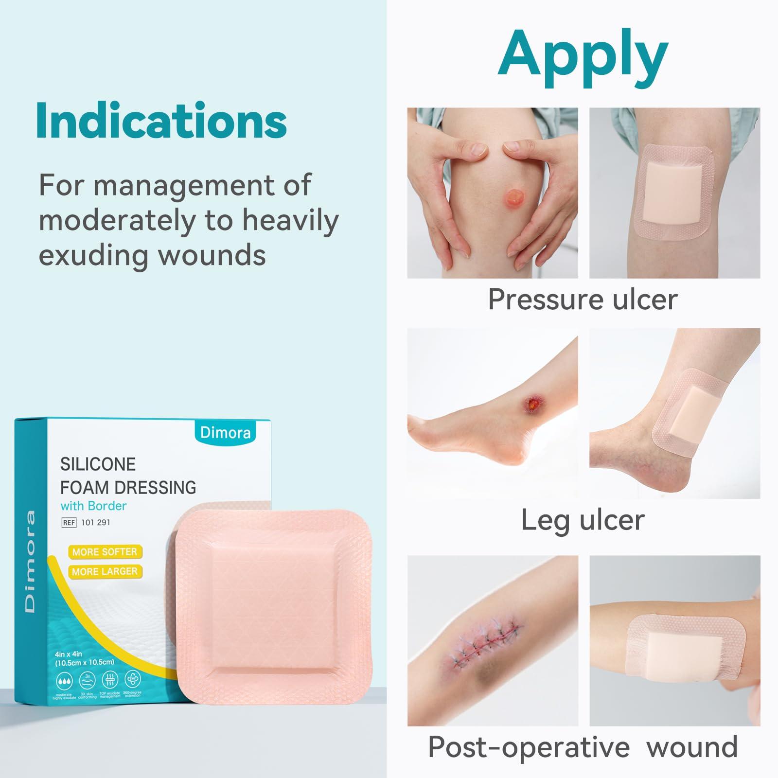 Dimora Dimora Silicone Super Absorbent Wound Dressings & Dimora Ultra Soft Silicone Foam Dressing 4\"x4\"