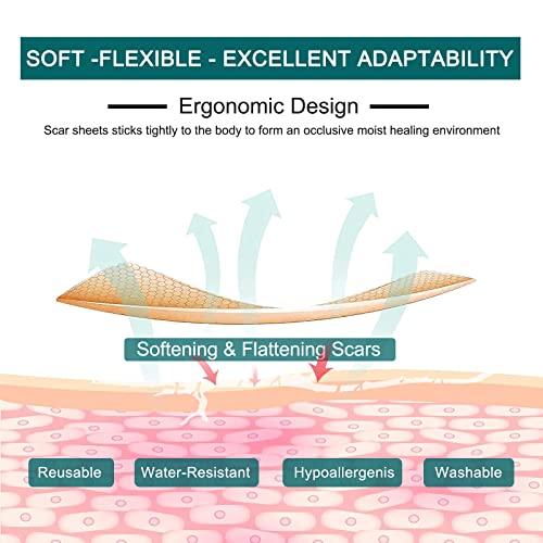 Moulis Silicone Scar Sheets (1.6” x 120” Roll-3M), Silicone Scar Tape Roll, Scar Silicone Strips, Reusable, Professional Scar Removal Sheets for C-Section, Surgery, Burn, Keloid, Acne et