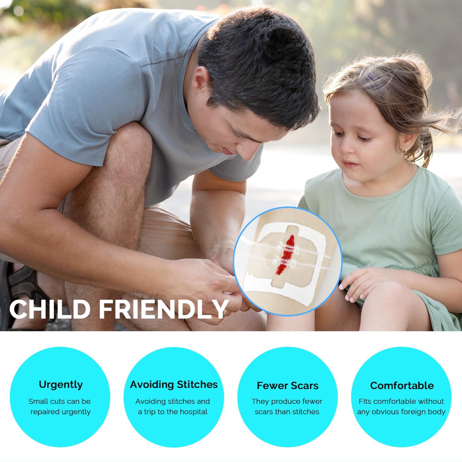 Greetmed Greetmed Zip Stitch Sutures Butterfly Bandaids 4 Pcs Zip Stitches for Wounds Care Laceration Closure Kit Zipstitch Bandages Quick Clot Emergency Zipstitch Wound Closure Device