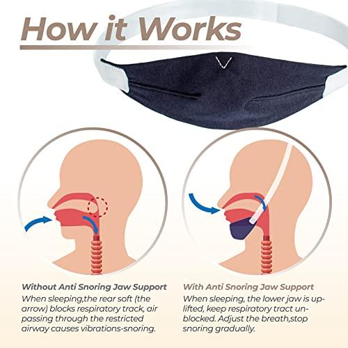 PalpitateC PalpitateC Upgrades Chin Strap Effective Mouth-Snoring Relief, Anti Snoring Men Women Universal, Adjustable Snoring Solution Effectively Regulate Snoring and Regulate Sleep, Chin Strap Resmed - 1 Pack