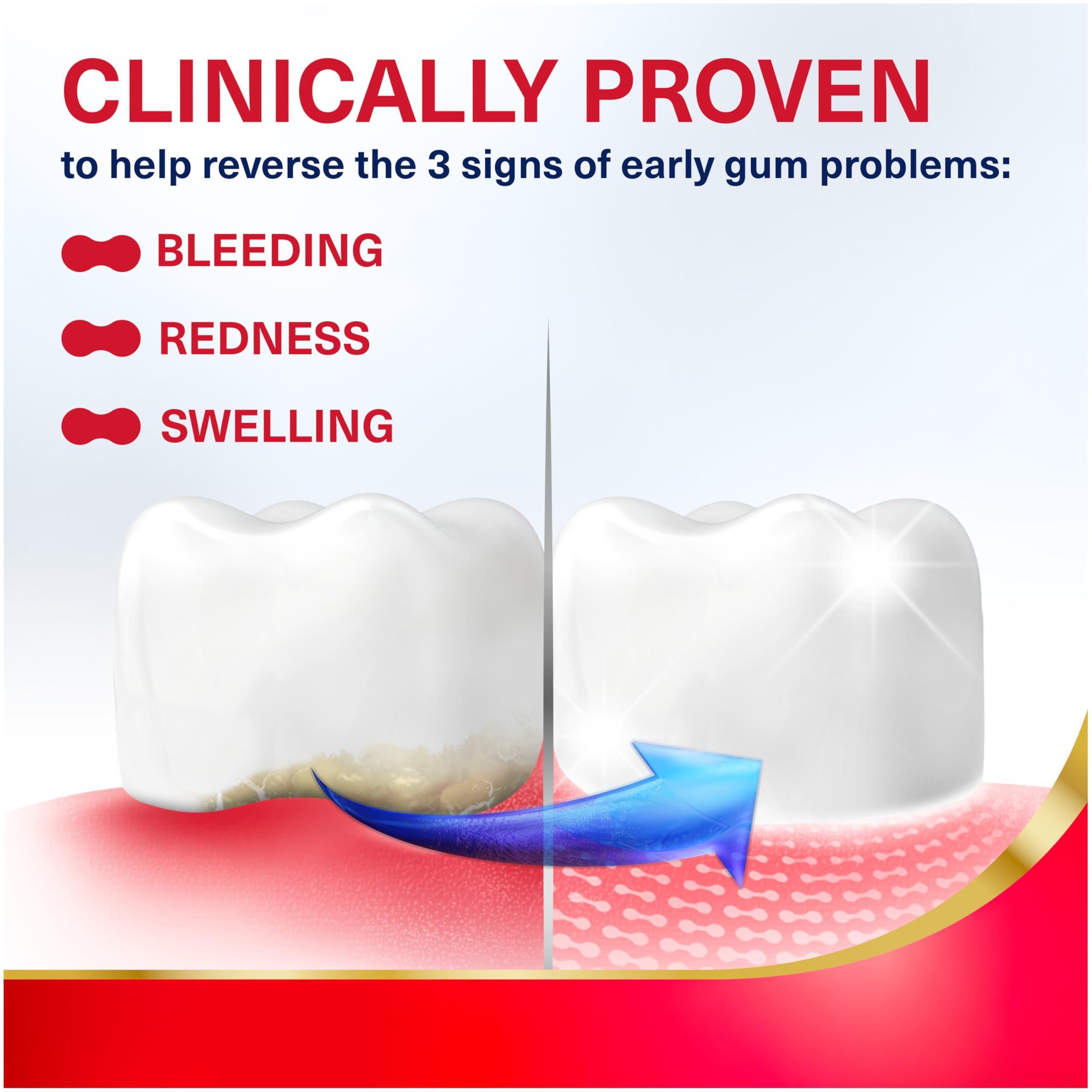 Parodontax Parodontax Active Gum Repair Toothpaste, Toothpaste To Help Reverse Signs Of Early Disease For Health, Fresh Mint Flavored - 3.4 Oz x 3