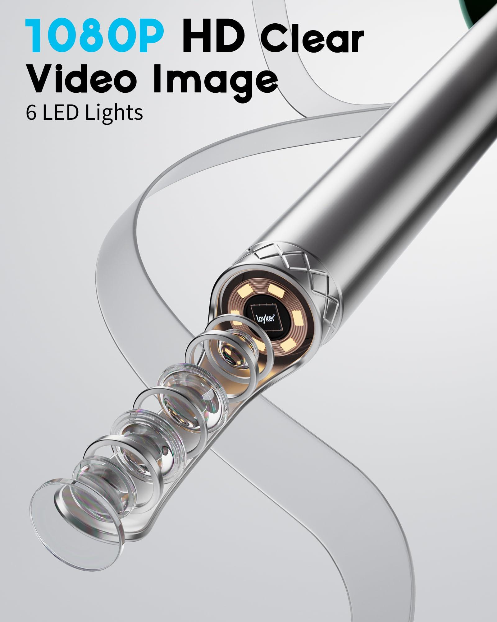 Loyker Ear Wax Removal Tool Camera Otoscope with Light, Ear Wax Removal Kit with 6 Ear Pick, Ear Camera- Green