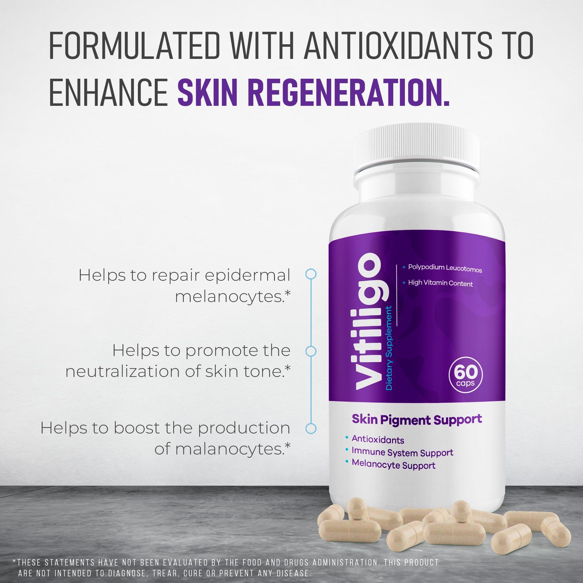 AURA VITAMINS AURA VITAMINS - Vitiligo Capsules 60 Count | 1 Month | Improve Skin Pigmentation Support and Reduce White Spots | Effective Vitiligo Supplement | Natural Solution for White Spots on Skin. (1)