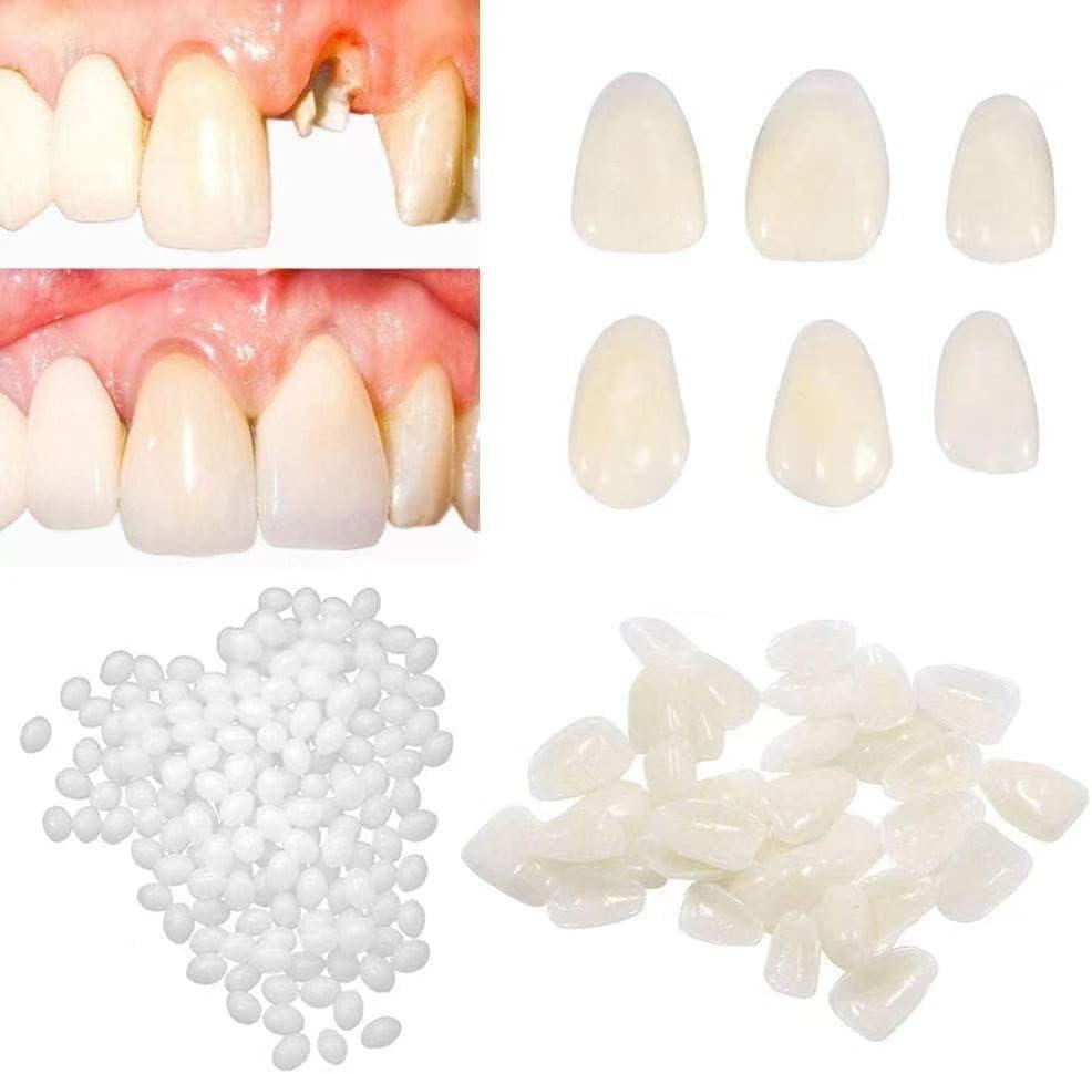 Healthyare Tooth Repair Kit-Thermal Fitting Beads Granules and Fake Teeth for Fixing Missing and Broken Tooth