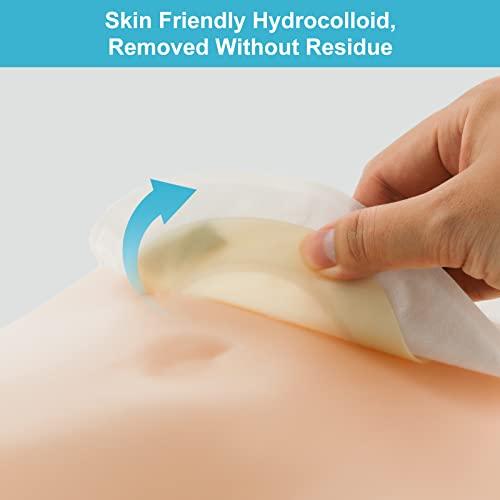 KONWEDA KONWEDA 20PCS Colostomy Bags, Ostomy Supplies, One-Piece Drainable Pouches with Closure for Ileostomy Stoma Care, Cut-to-Fit, Max 70mm