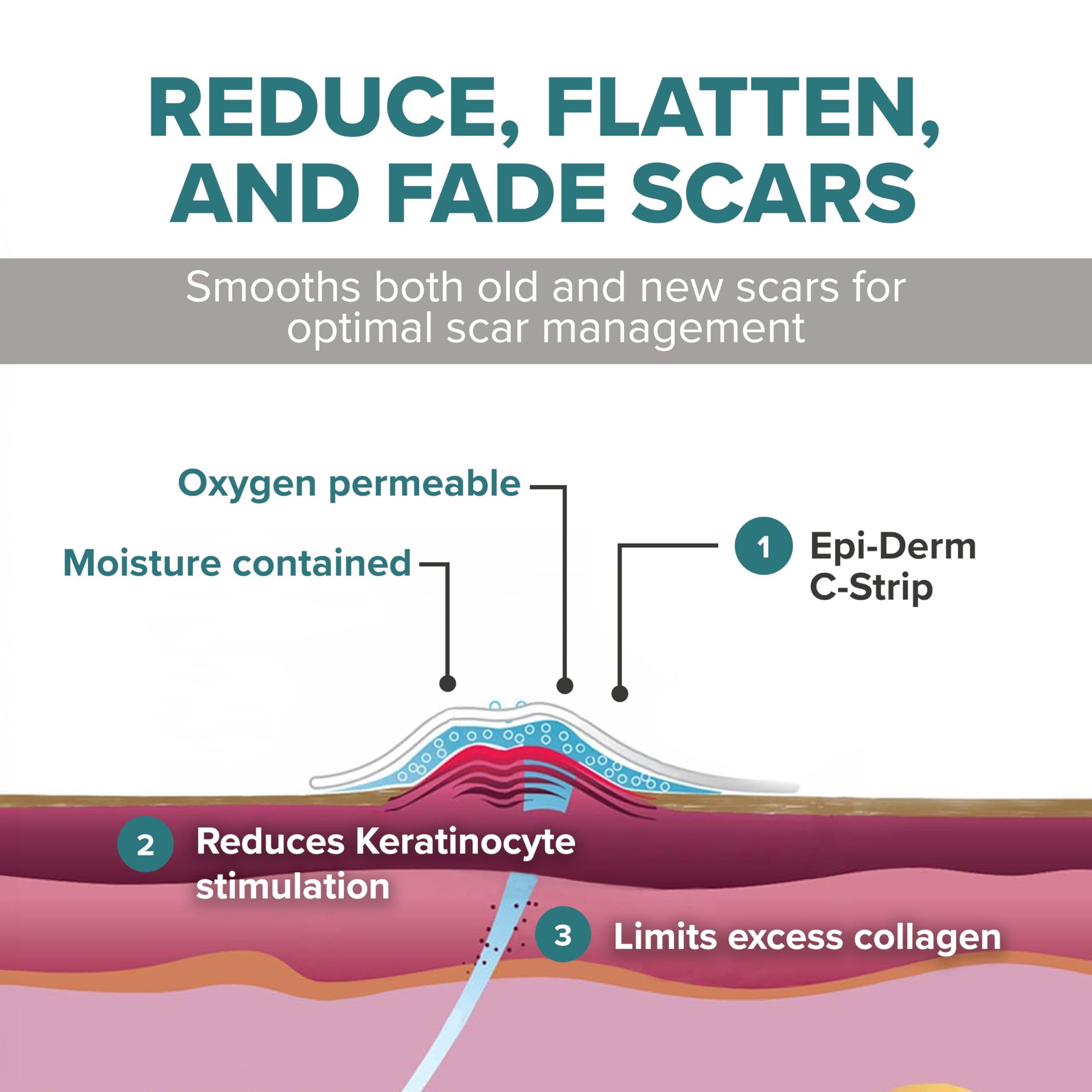 BIODERMIS EpiDerm Silicone Gel Scar Strips - Premium-Grade Silicone Scar Tape for Optimal Scar Care-Versatile, Flexible & Reusable - Ideal for C-Section, Tummy Tuck & Cardiac Surgery Scars - 1.4\"x6\", Clear