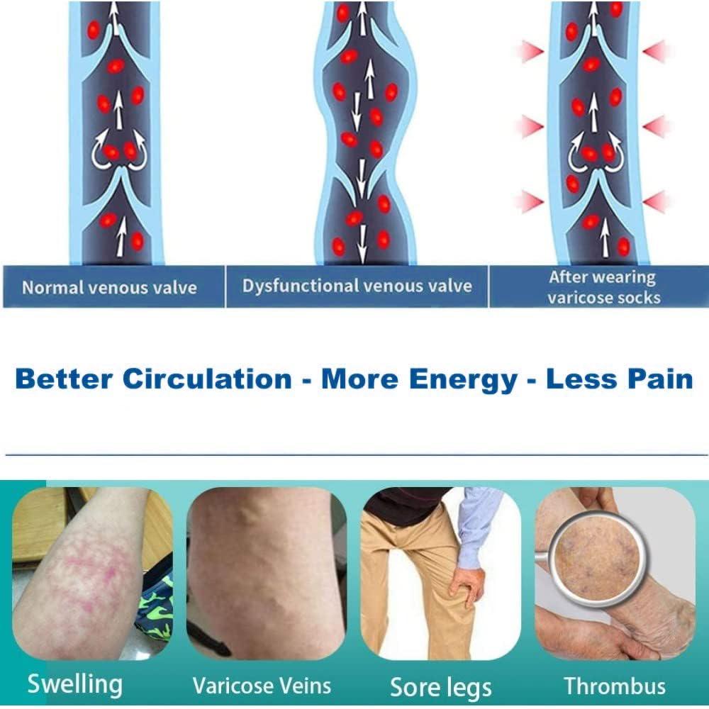 Cyxunand Anti Embolism Ted Hose Thigh High 20-32 mmHg Compression Stocking Toeless,Compression Socks Support for Women & Men (XL, Black(Toeless ))