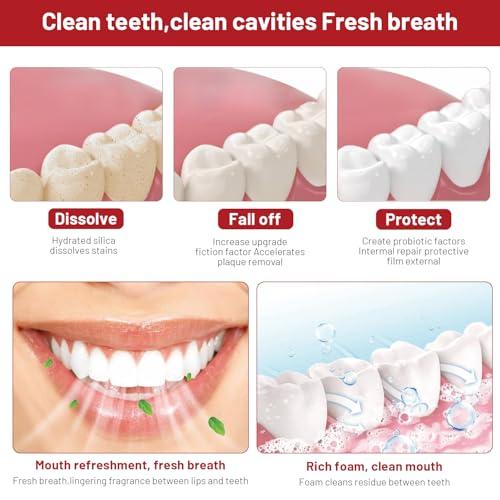 Mrryiio Sp10 Probiotic Toothpaste,Sp-10 Ultra Whitening Toothpaste,Probiotics Bright White Toothpaste,Sp-10 Probiotic Toothpaste,Sp10 Toothpaste,Fresh Breath,Deep Cleaning Care Toothpaste2Pcs