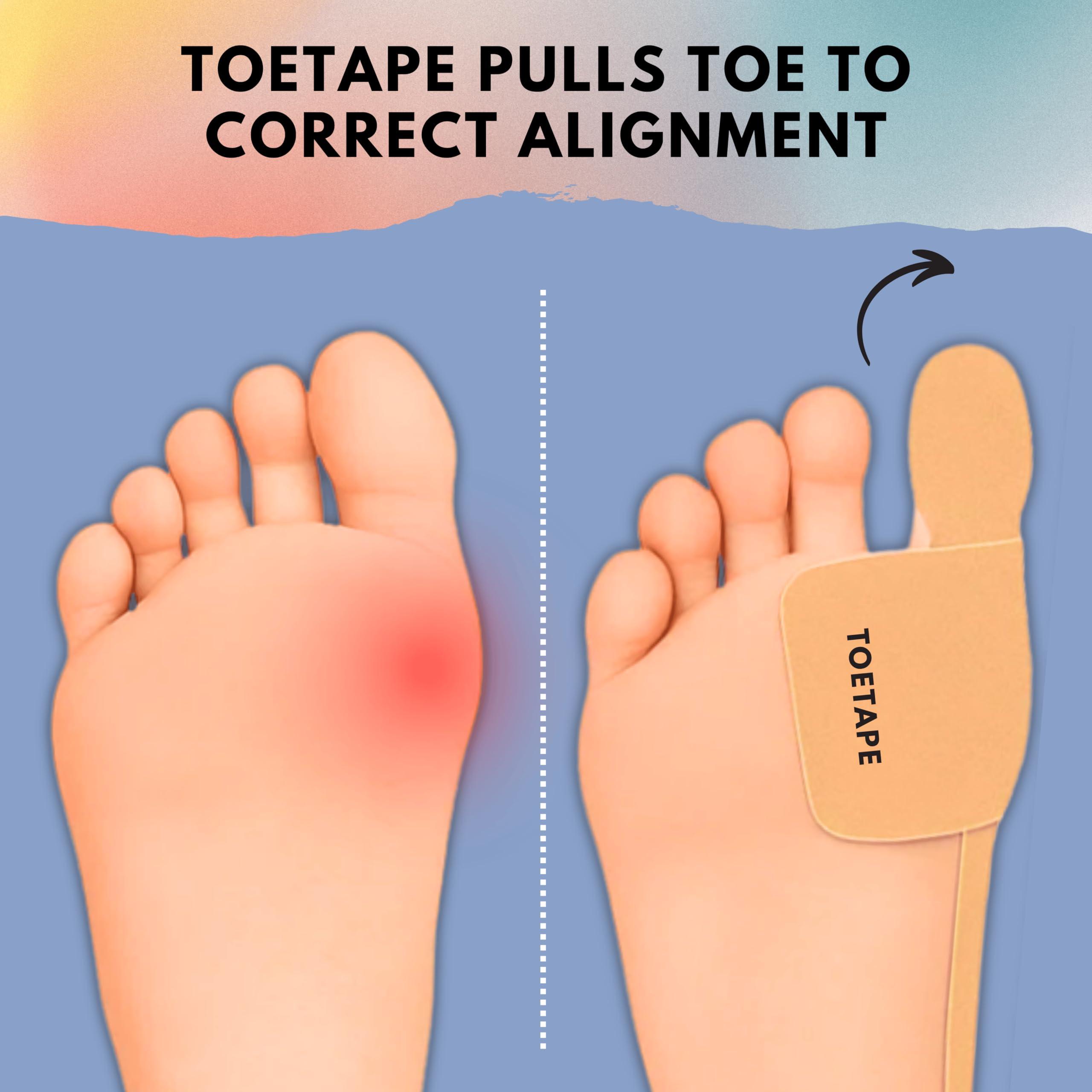 ToeTape Bunion Correction & Pain Relief Tape | 40 Count | Precut Kinesiology Tape for Bunions, Big Toe Sprains, Pain Relief and Support | Hypoallergenic and Sweatproof (Nude)